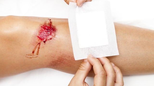 treat leg injuries at a first aid course near me